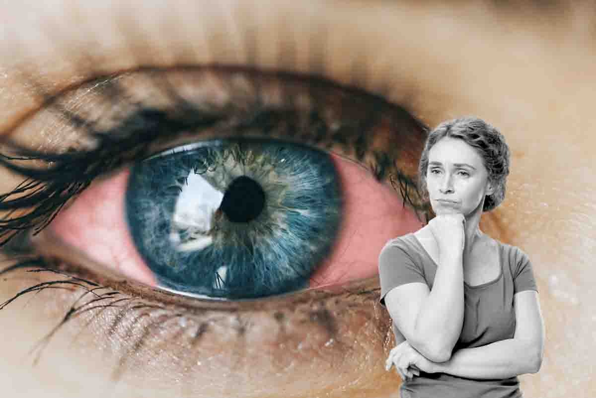 sintomo occhi rossi: quando consultare medico
